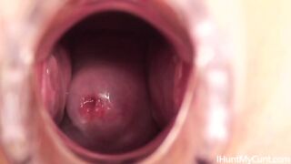 Young nurse gapes her pussy and shows her cervix through the speculum