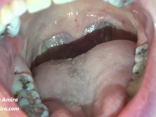 Dancing Uvula