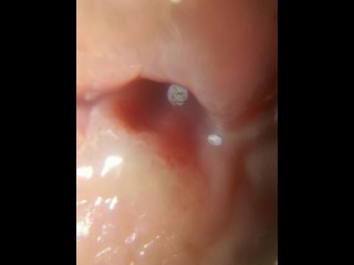 head and foreskin superzoom