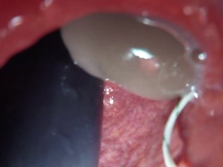 Internal View Two Bad Dragon One Asshole DP Fuck and Cum Quickie