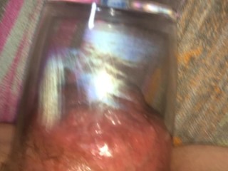 starting anal pump