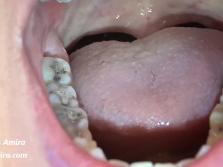 Teeth and Tongue Exploration