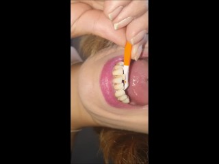 Tongue check and teeth cleaning