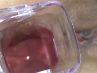 Watch anal inside using Speculum Anus close-up