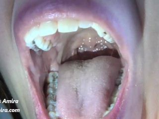 Wide Open Mouth